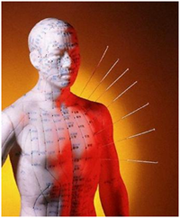 Acupuntura