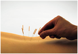 Acupuntura